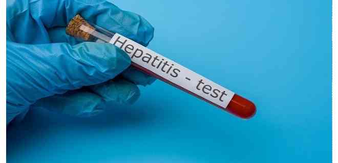 ¿Qué causa la hepatitis?