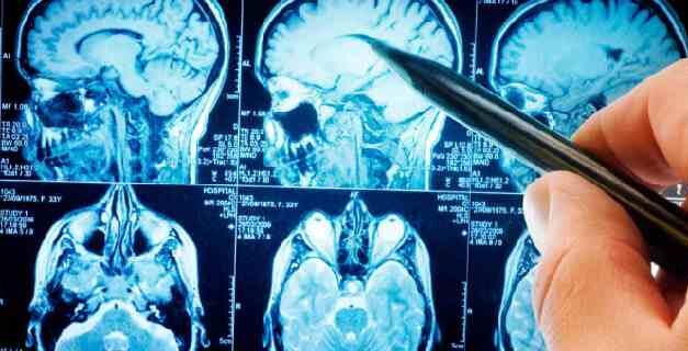 Uruguay confirma nuevos casos de encefalitis equina en humanos
