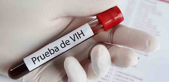 Aumenta en un 20 % los casos de VIH-Sida en Monagas